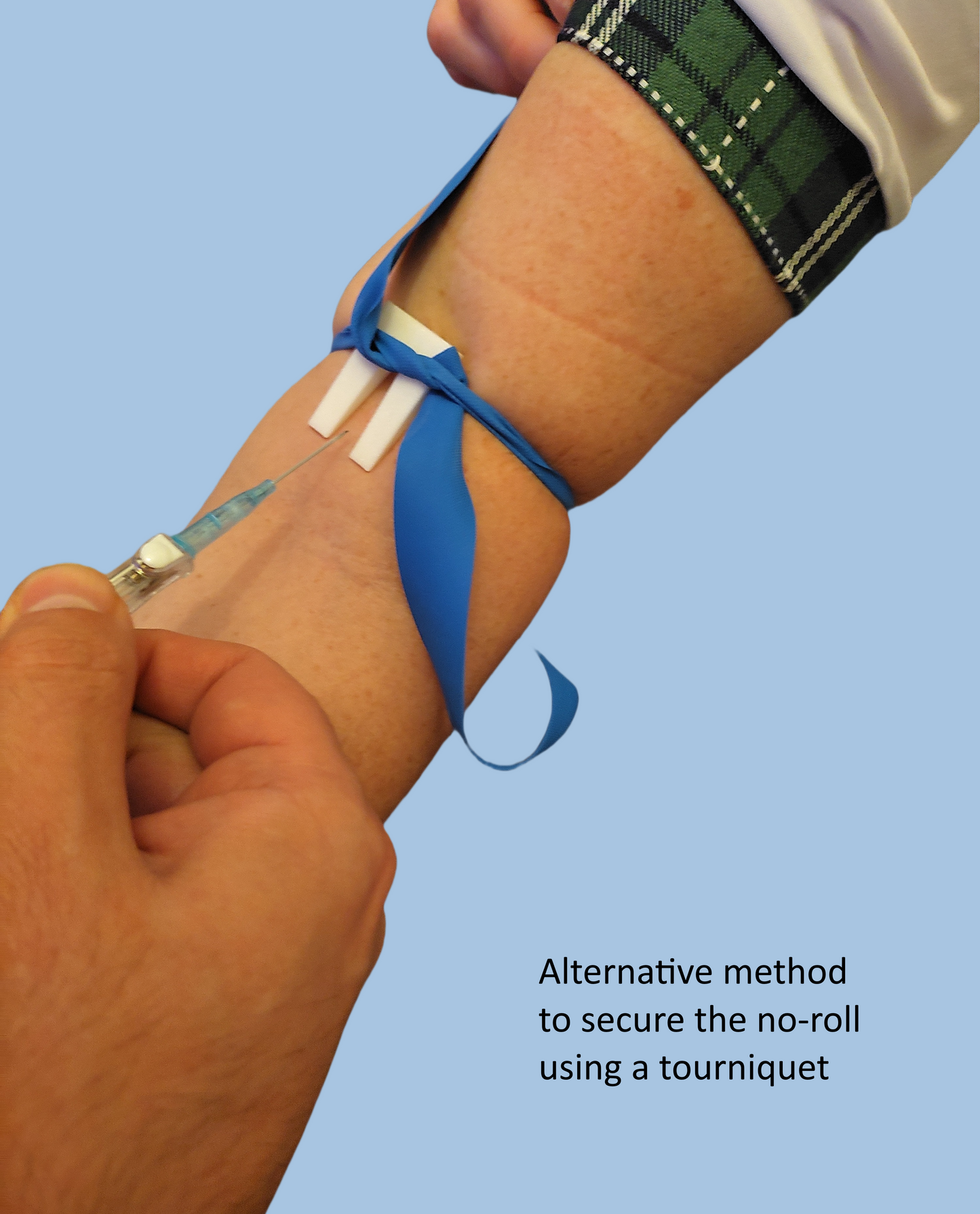 IV No-Roll Vein Stabilizer